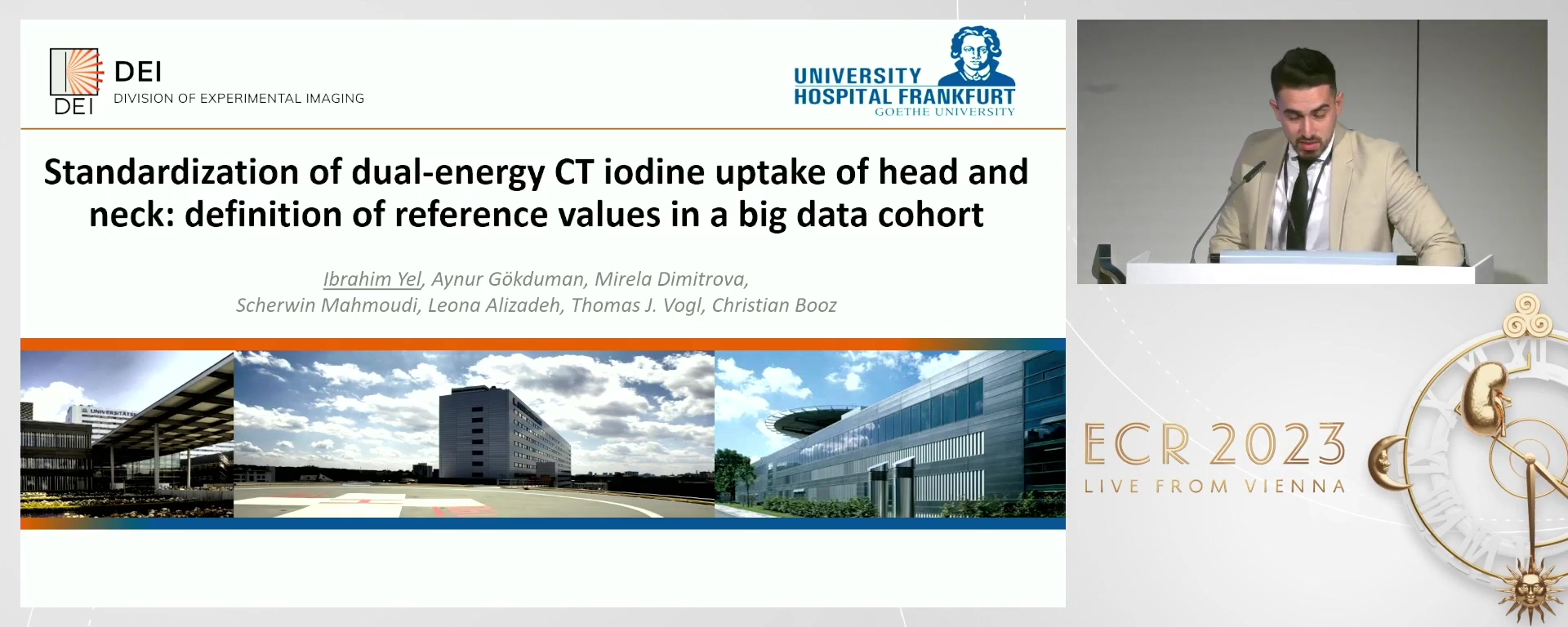 Standardisation of dual-energy CT iodine uptake of head and neck: definition of reference values in a big data cohort