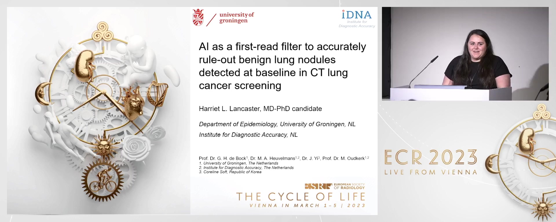 AI shows promise for future use as a first-read filter to accurately rule out benign lung nodules detected at baseline in CT lung cancer screening