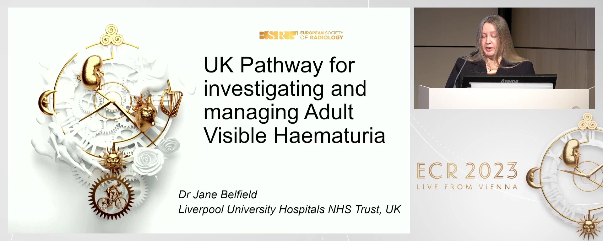 UK pathway for investigating and managing adult visible haematuria