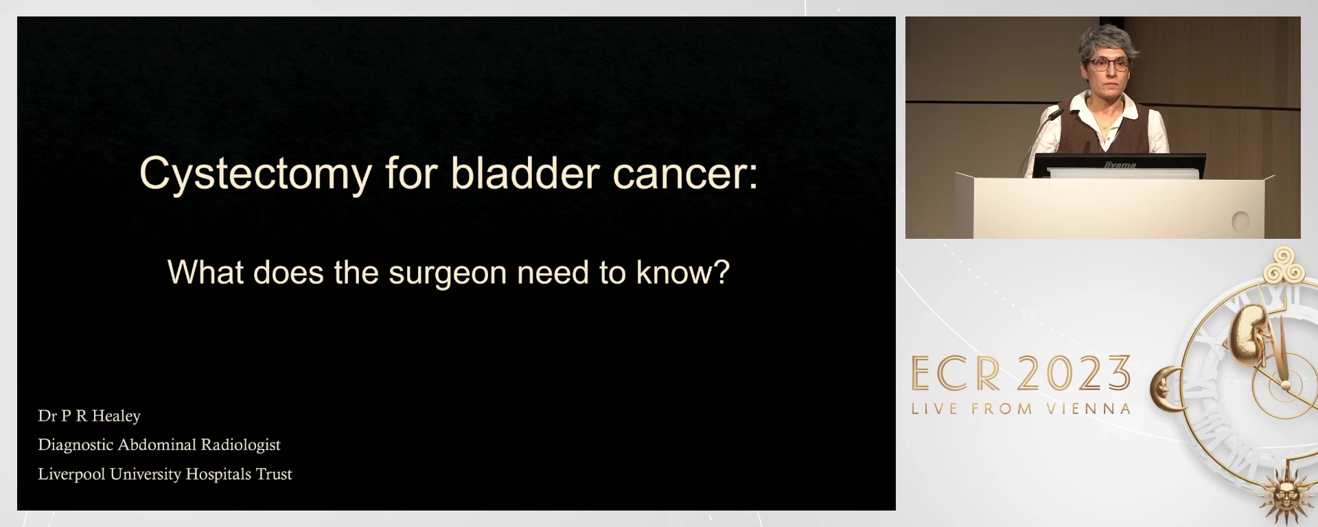 Cystectomy for bladder cancer: what does the surgeon need to know?