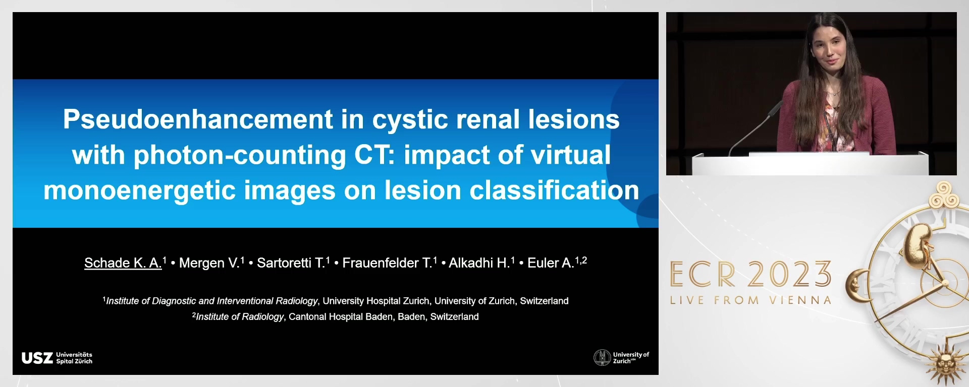 Pseudoenhancement in cystic renal lesions with photon-counting CT: impact of virtual monoenergetic images on lesion classification