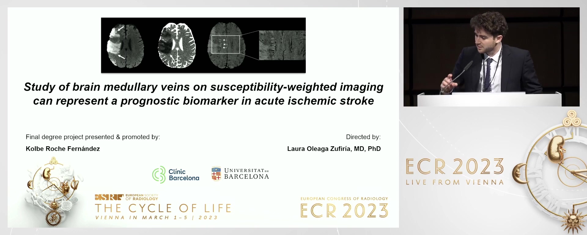 Study of brain medullary veins on susceptibility-weighted imaging can represent a prognostic biomarker in acute ischemic stroke