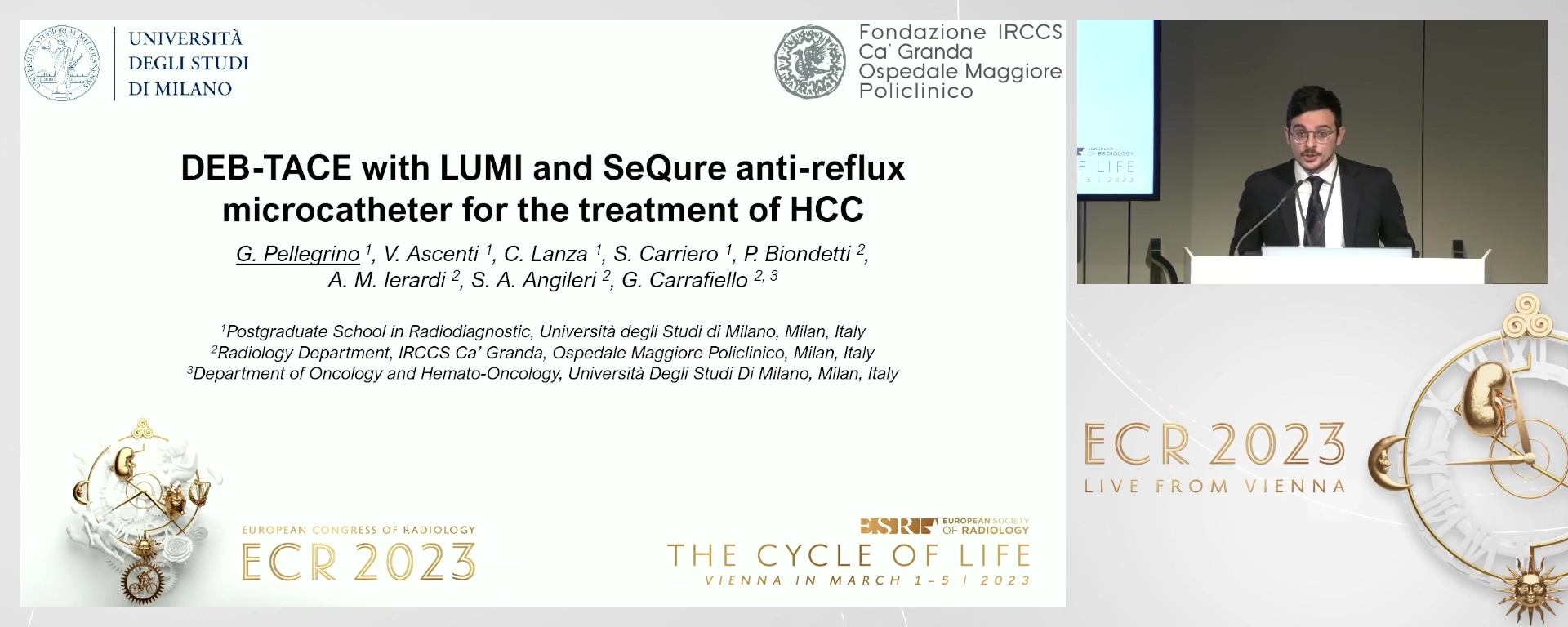 DEB-TACE with LUMI and SeQure anti-reflux microcatheter for the treatment of HCC