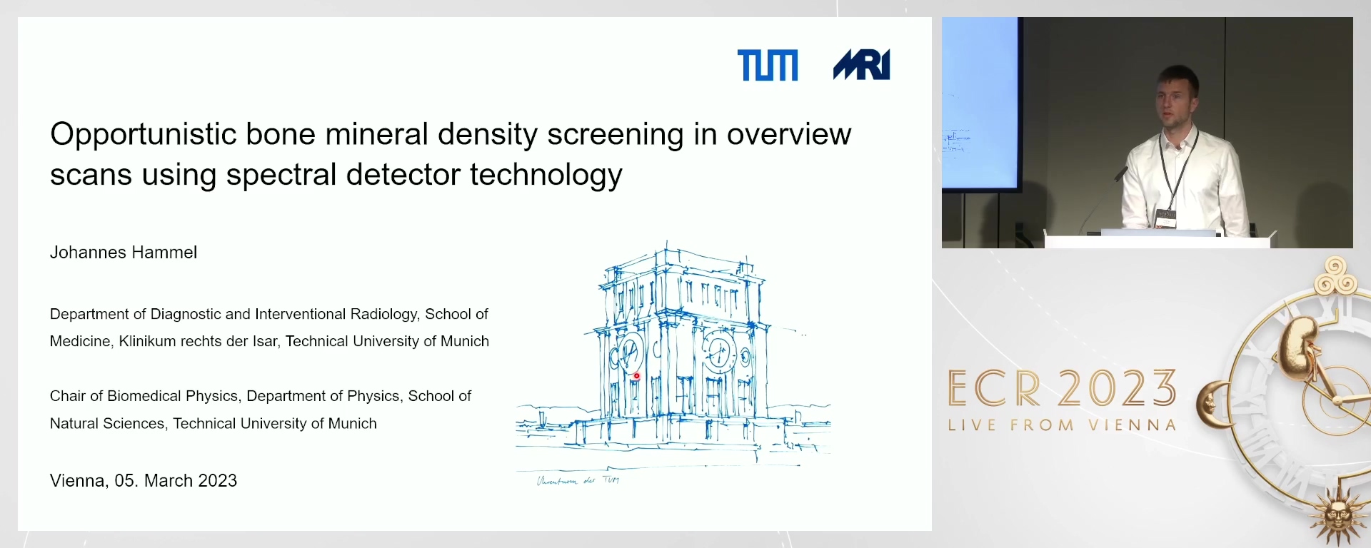 Opportunistic bone mineral density screening in overview scans using spectral detector technology