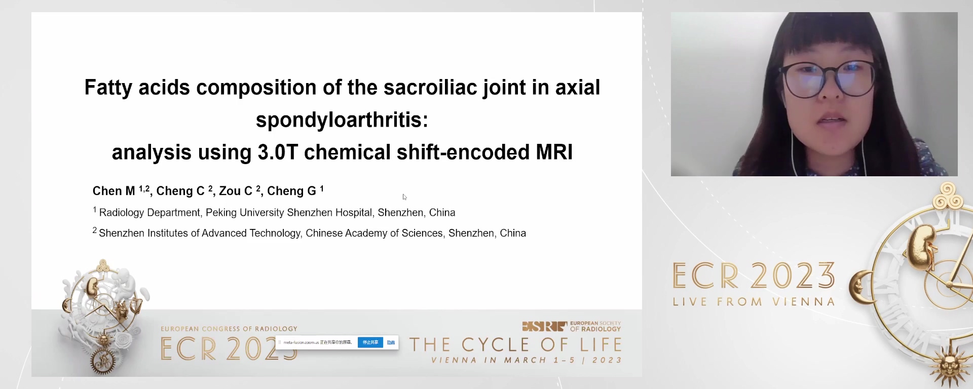 Fatty acids composition of the sacroiliac joint in axial spondyloarthritis: analysis using 3.0 T chemical shift-encoded MRI