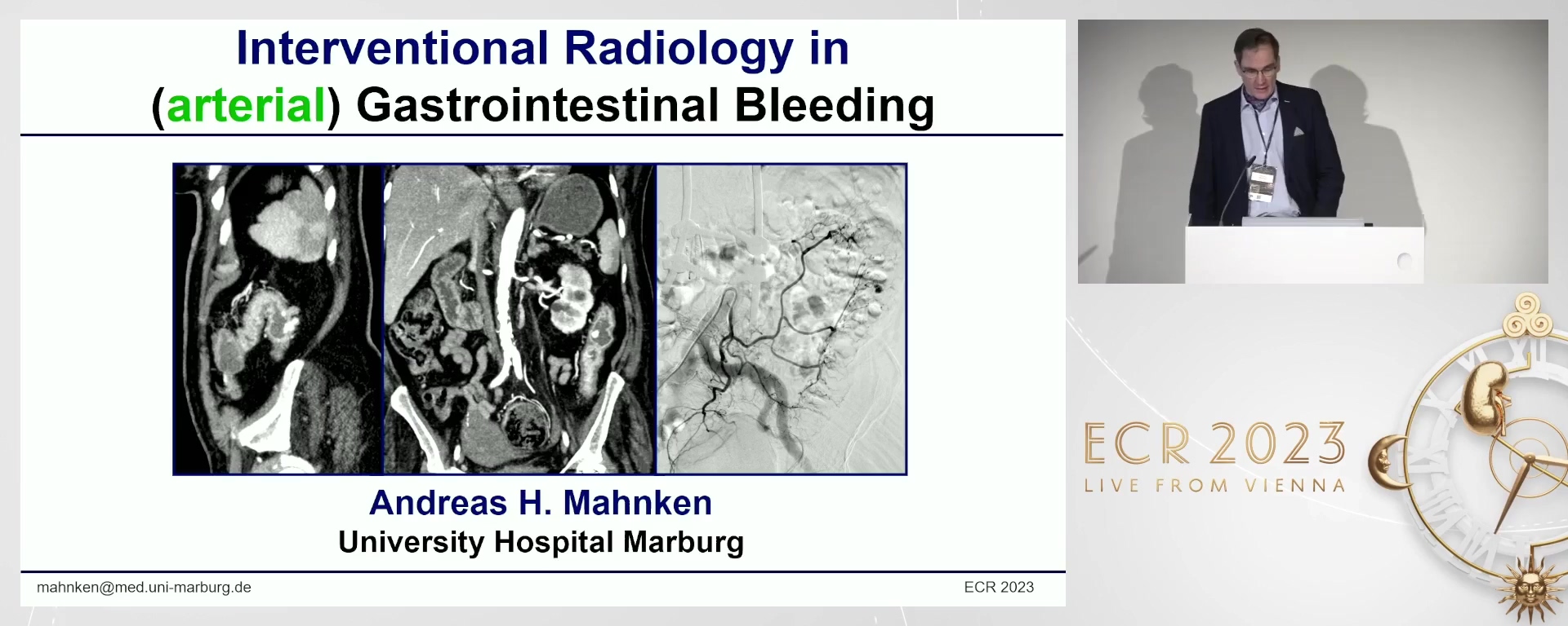 Management of GI bleeding: the role of interventional radiology