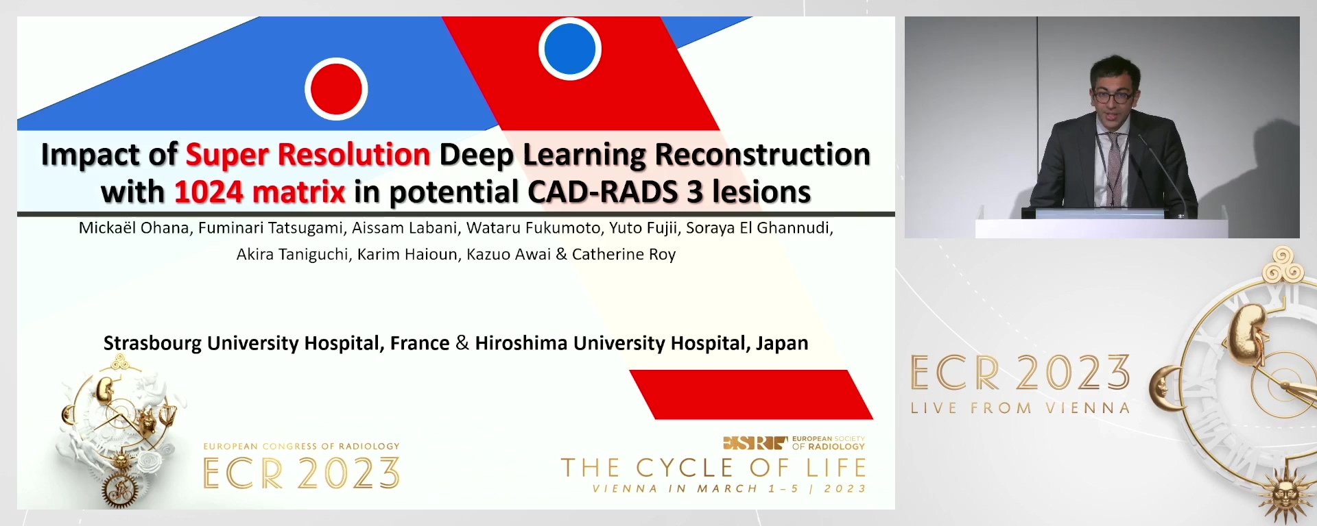Impact of super resolution deep learning reconstruction with 1024 matrix in potential CAD-RADS 3 lesions: retrospective analysis of 50 cases - Mickaël  Ohana, Schiltigheim / FR