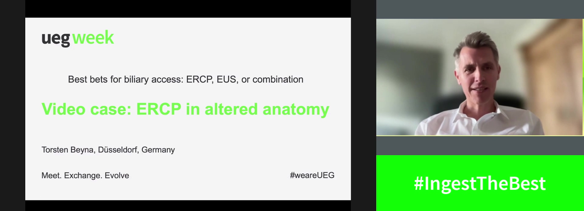 Video case: ERCP in altered anatomy
