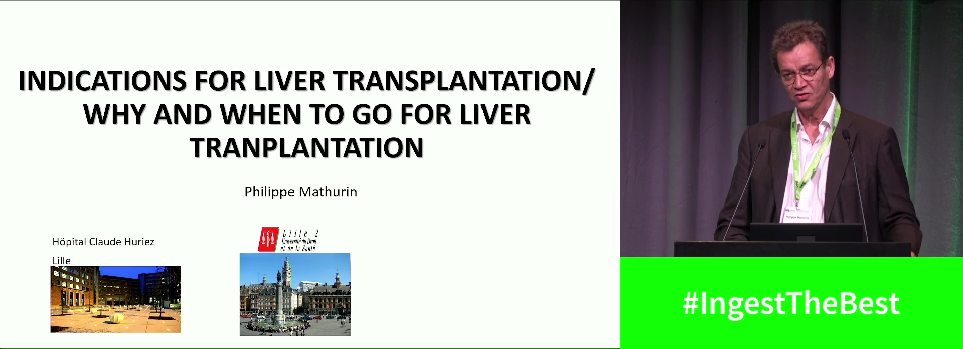 Indications for liver transplantation: Why and when to go for liver transplantation?