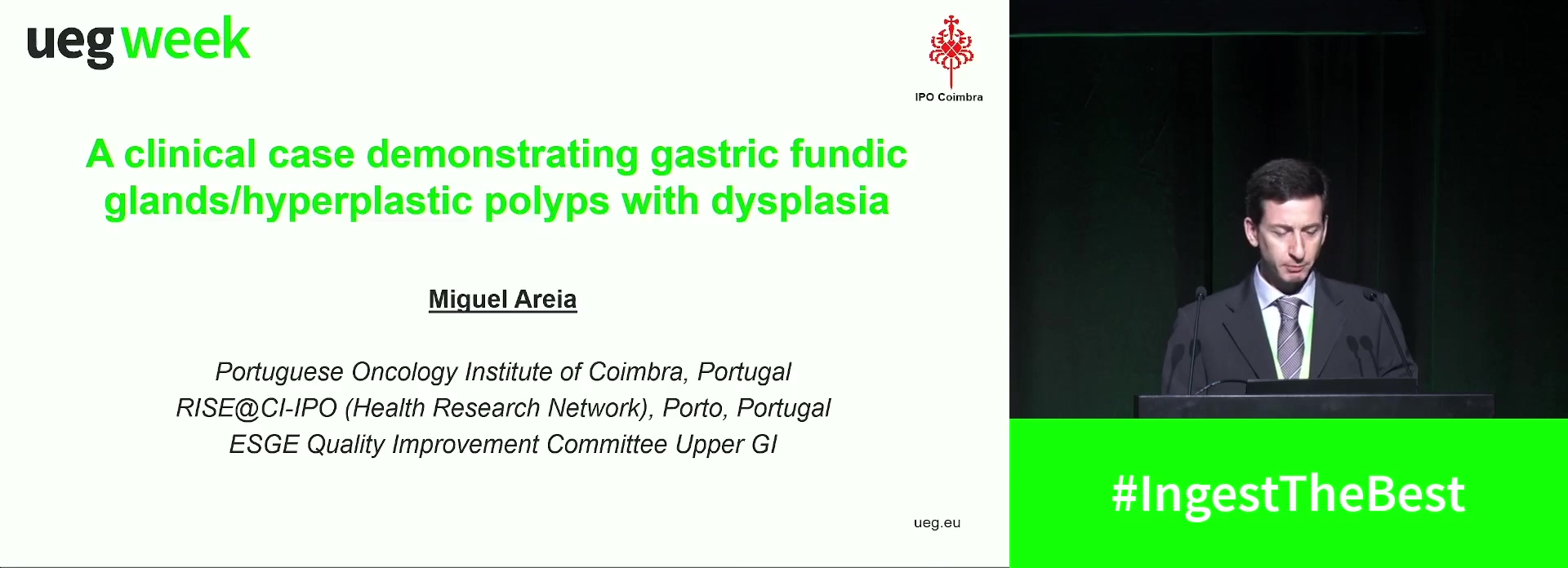 A clinical case demonstrating gastric fundic glands/hyperplastic polyps with dysplasia