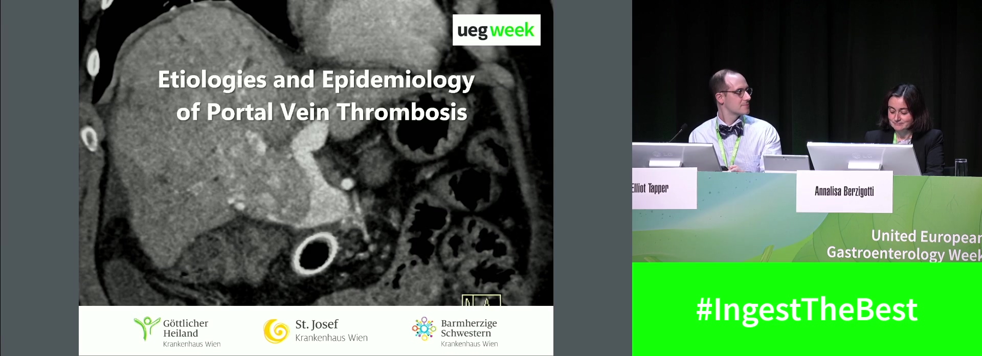 Etiologies and epidemiology  of portal vein thrombosis