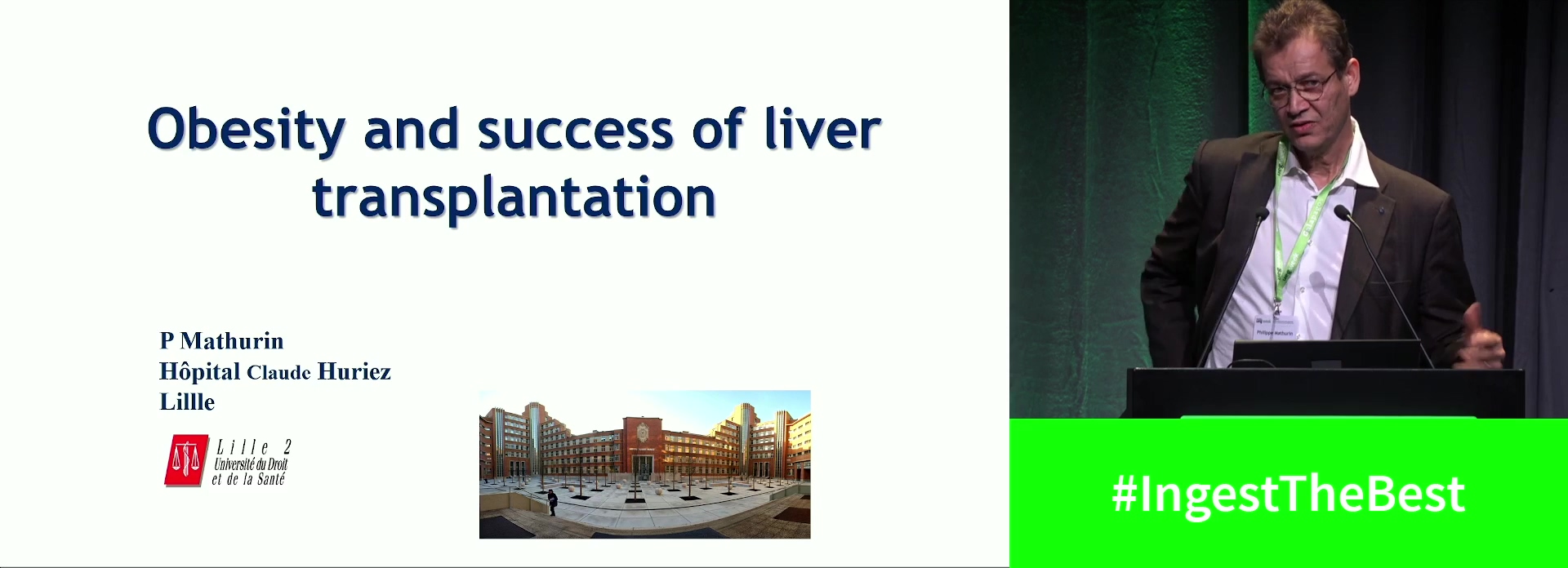 Obesity and success of liver transplantation