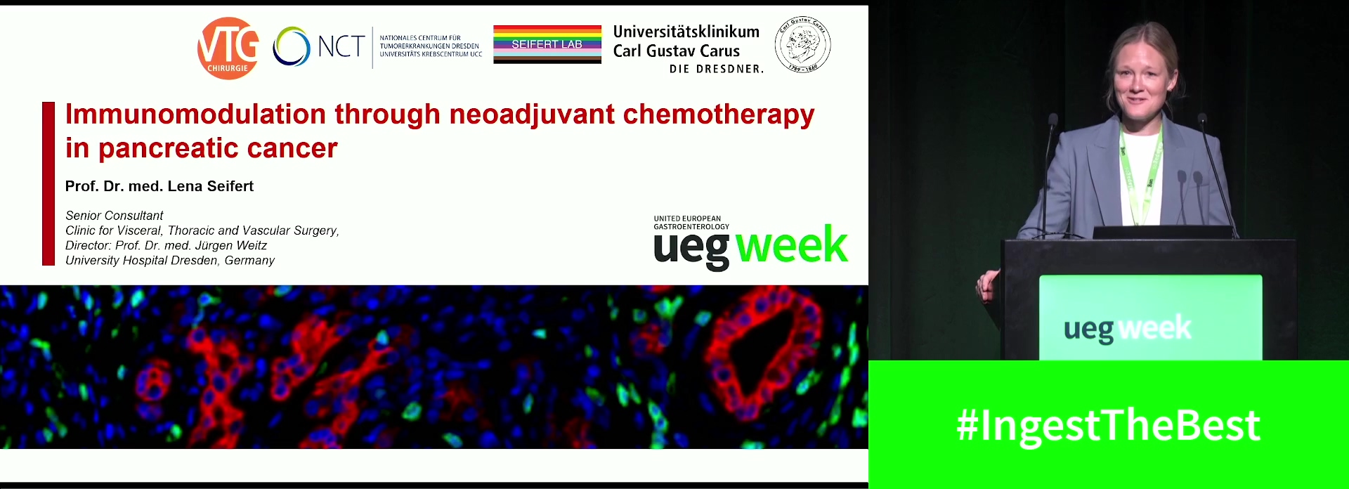 Immunomodulation through neoadjuvant chemotherapy in pancreatic cancer