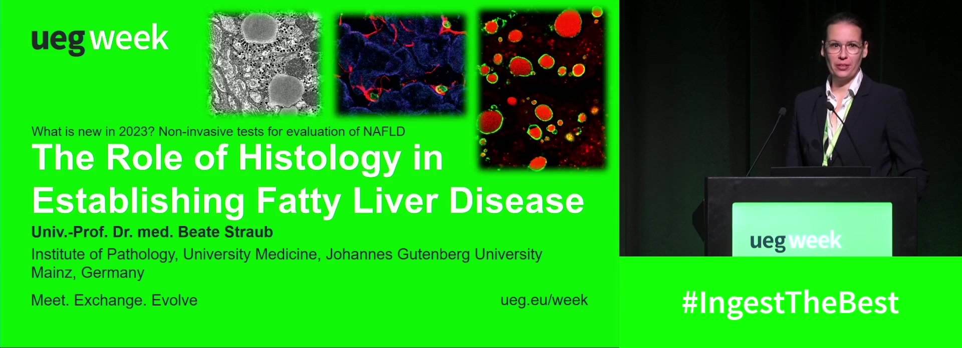 The role of liver histology in establishing fatty liver disease