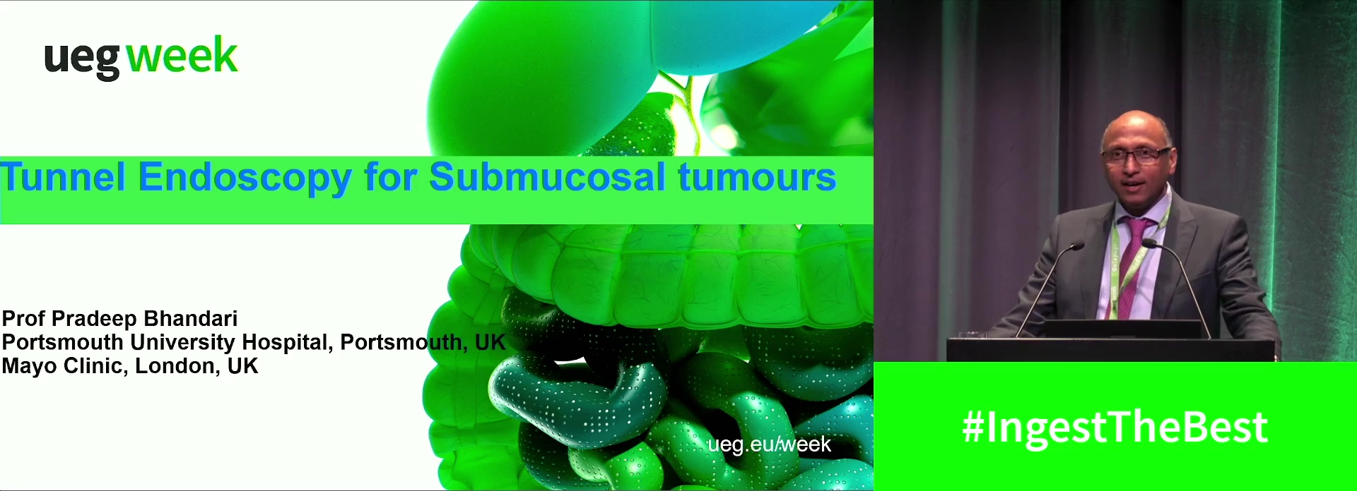 Tunnel endoscopy for submucosal tumours