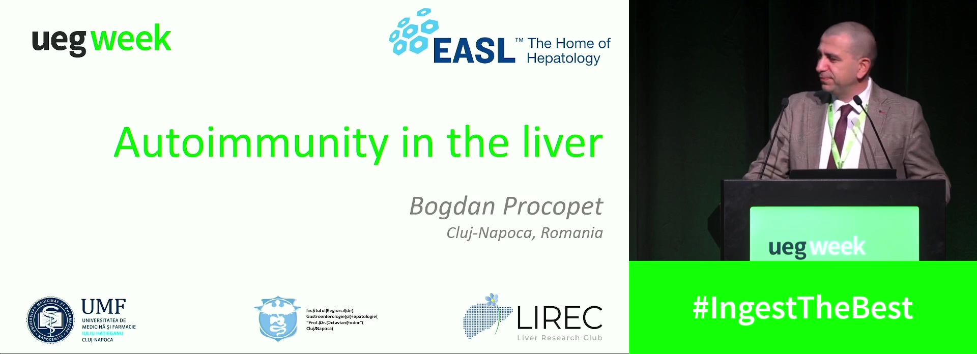 Autoimmunity in the liver