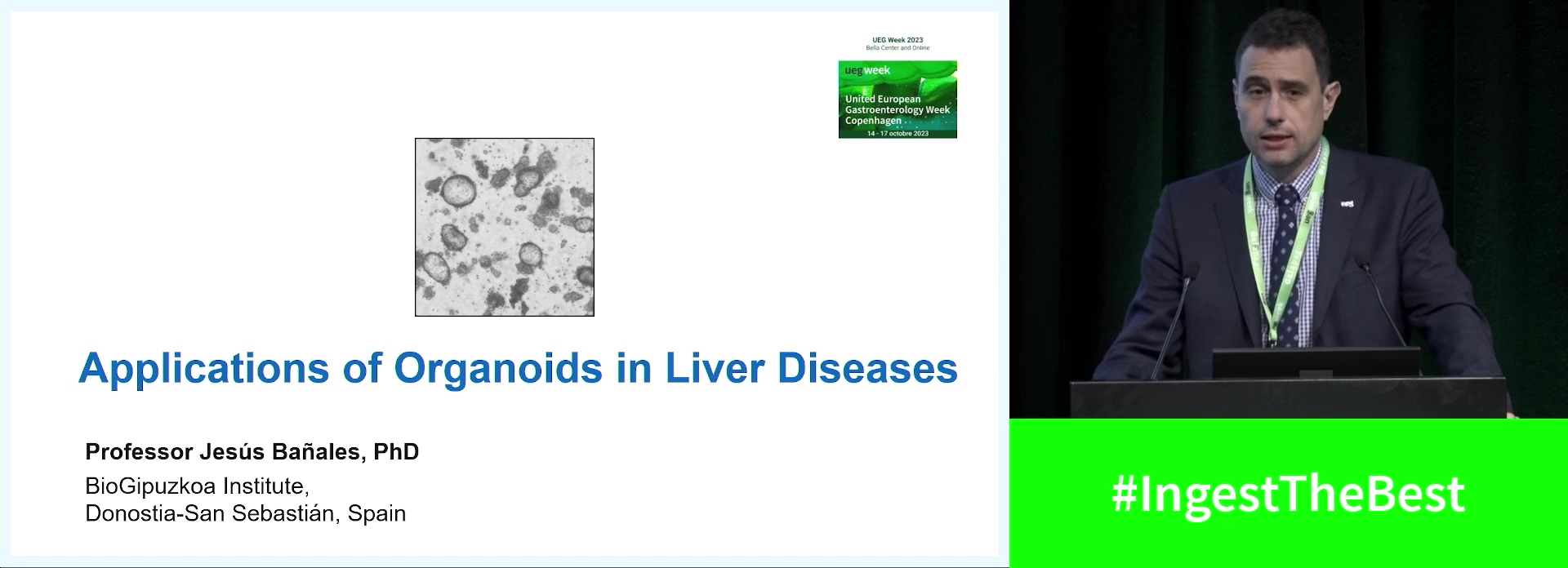 Applications of organoids in liver diseases