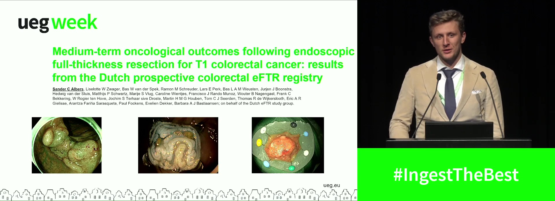 MEDIUM-TERM ONCOLOGICAL OUTCOMES FOLLOWING ENDOSCOPIC FULL-THICKNESS RESECTION FOR T1 COLORECTAL CANCER: RESULTS FROM THE DUTCH PROSPECTIVE COLORECTAL EFTR REGISTRY