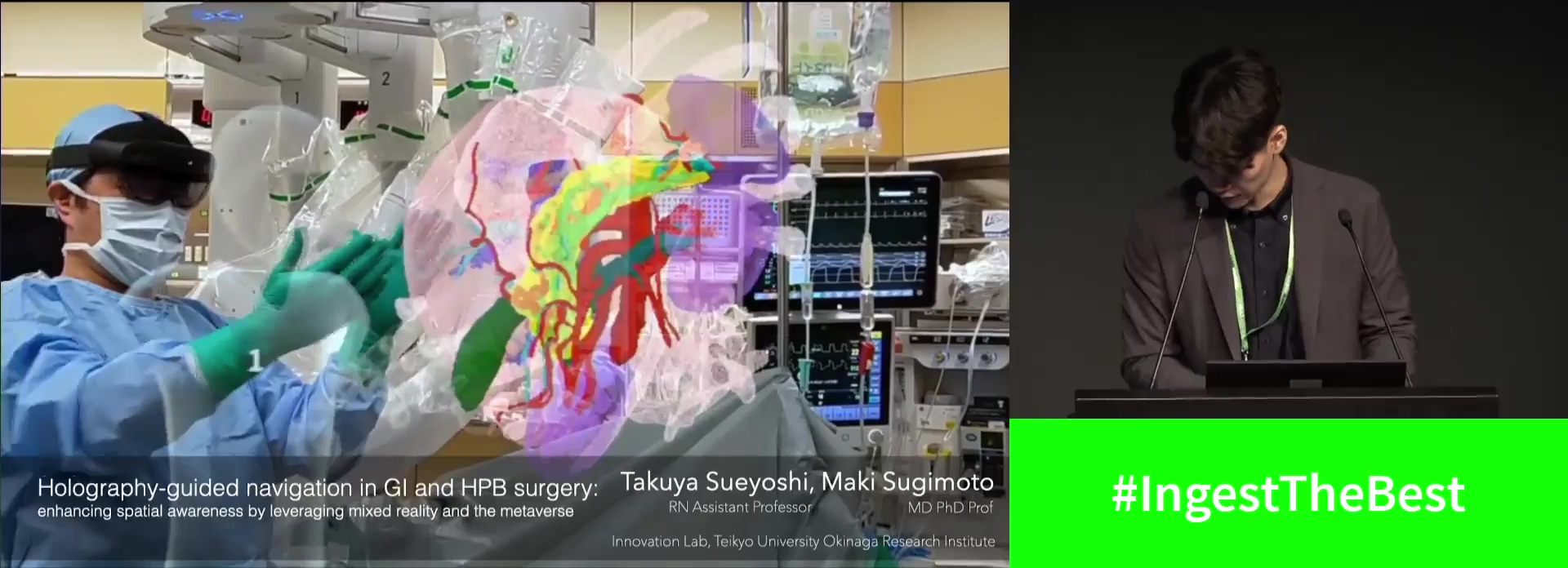 <em>HOLOGRAPHY-GUIDED</em> NAVIGATION IN GI AND HPB SURGERY: ENHANCING SPATIAL AWARENESS BY LEVERAGING MIXED REALITY AND THE METAVERSE