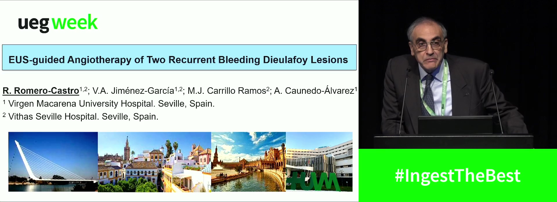 EUS-GUIDED ANGIOTHERAPY OF TWO RECURRENT BLEEDING DIEULAFOY LESIONS