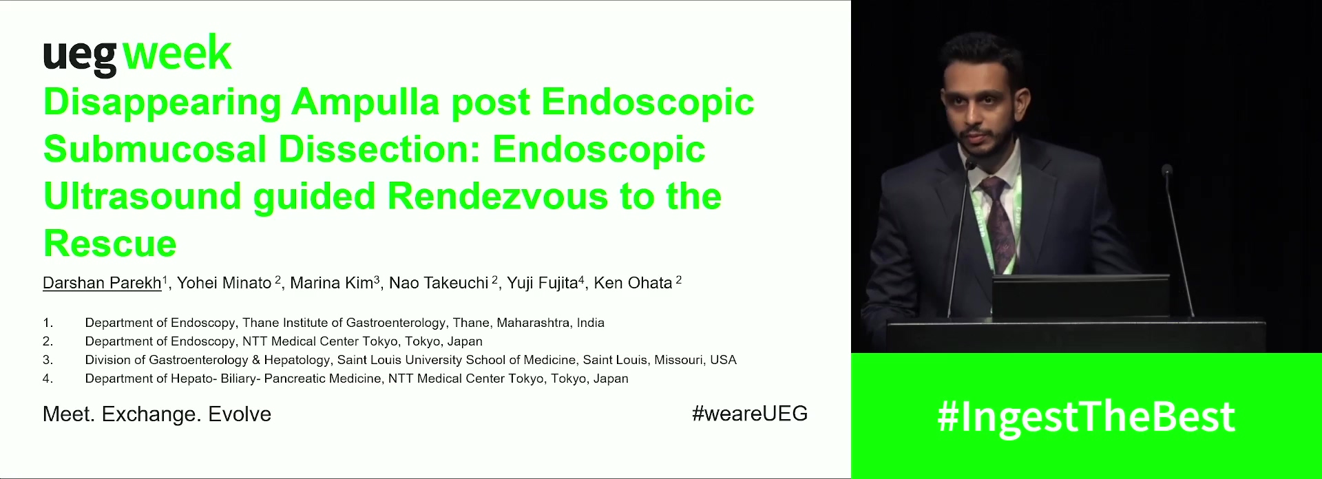 DISAPPEARING AMPULLA POST ENDOSCOPIC SUBMUCOSAL DISSECTION: ENDOSCOPIC ULTRASOUND GUIDED RENDEZVOUS TO THE RESCUE