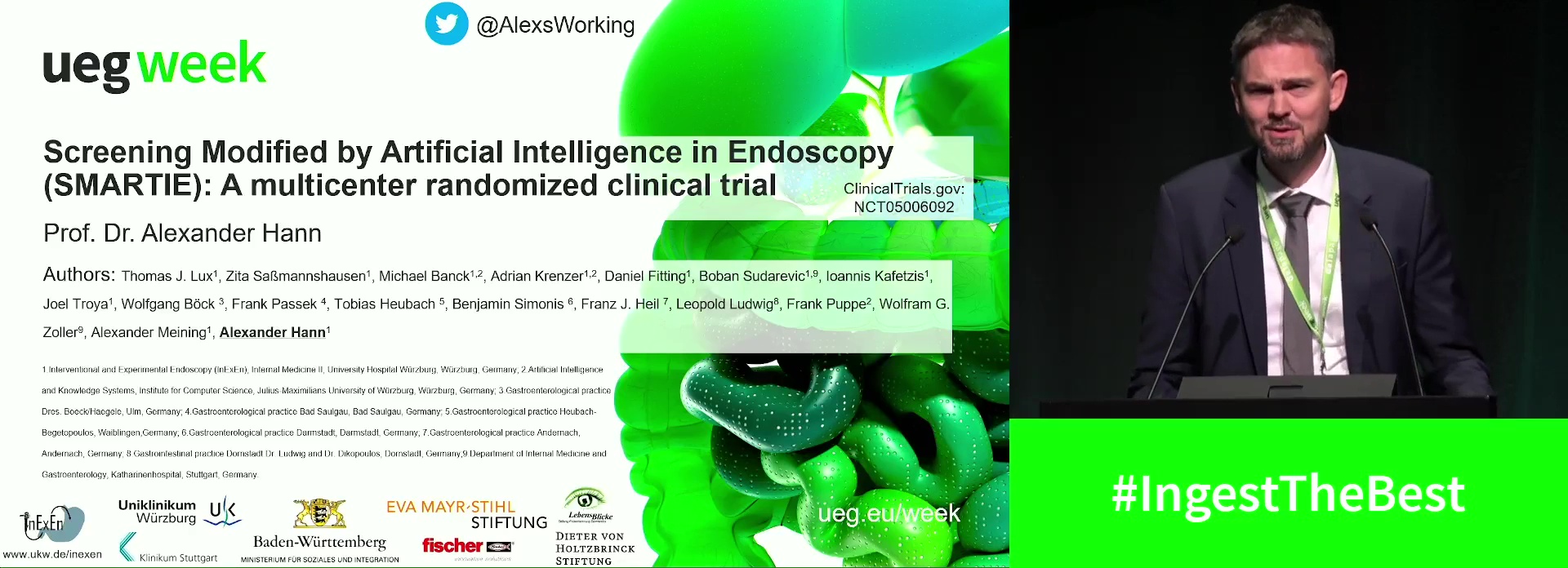 SCREENING MODIFIED BY ARTIFICIAL INTELLIGENCE IN ENDOSCOPY (SMARTIE): A MULTICENTER RANDOMIZED CLINICAL TRIAL