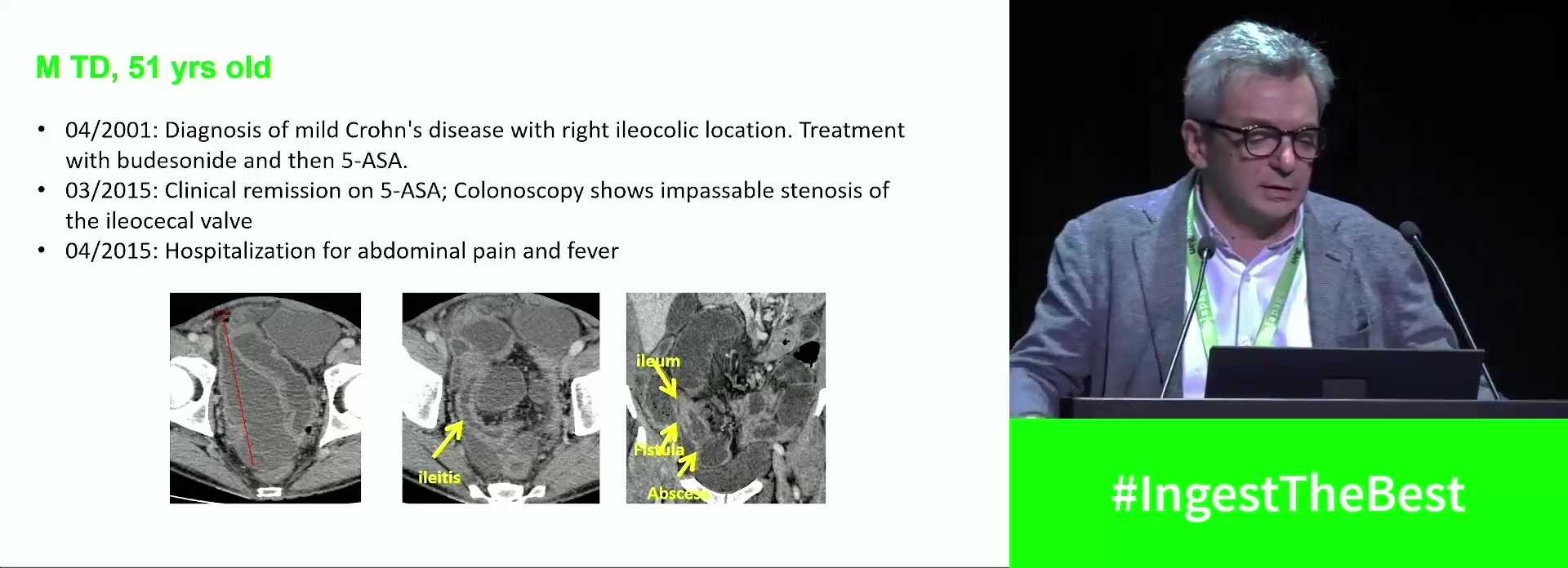 Complex IBD patient (Complete Session)