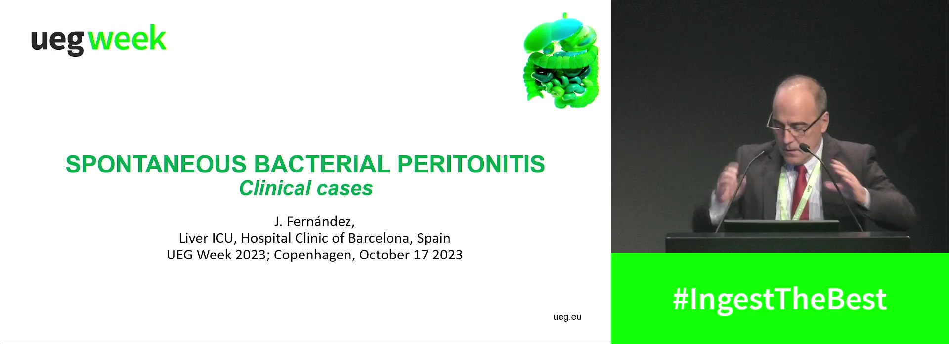 Spontaneous bacterial peritonitis (Complete Session)