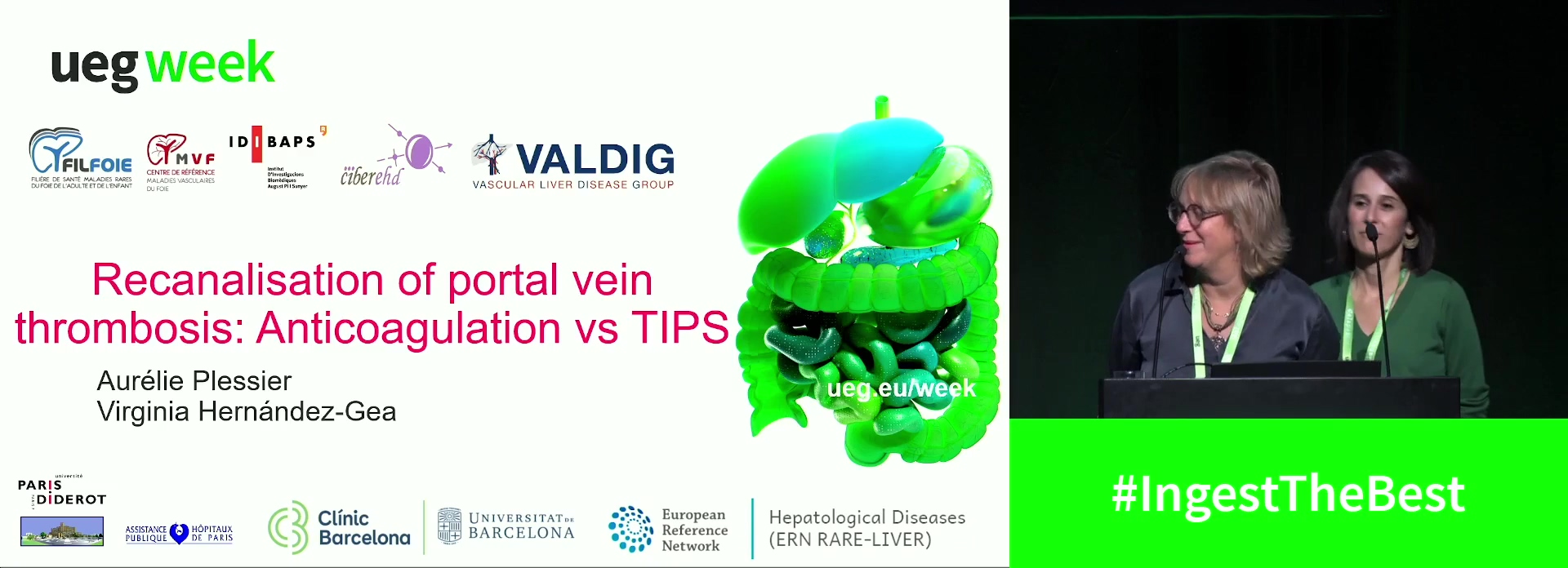 Recanalisation of portal vein thrombosis: Anticoagulation or TIPS