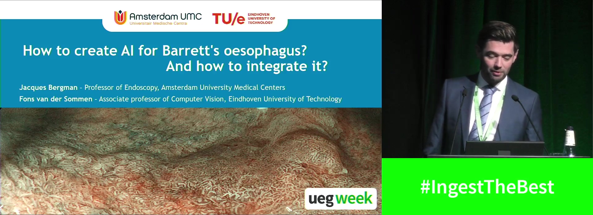 How to create AI for Barrett's oesophagus and how to integrate it in its management