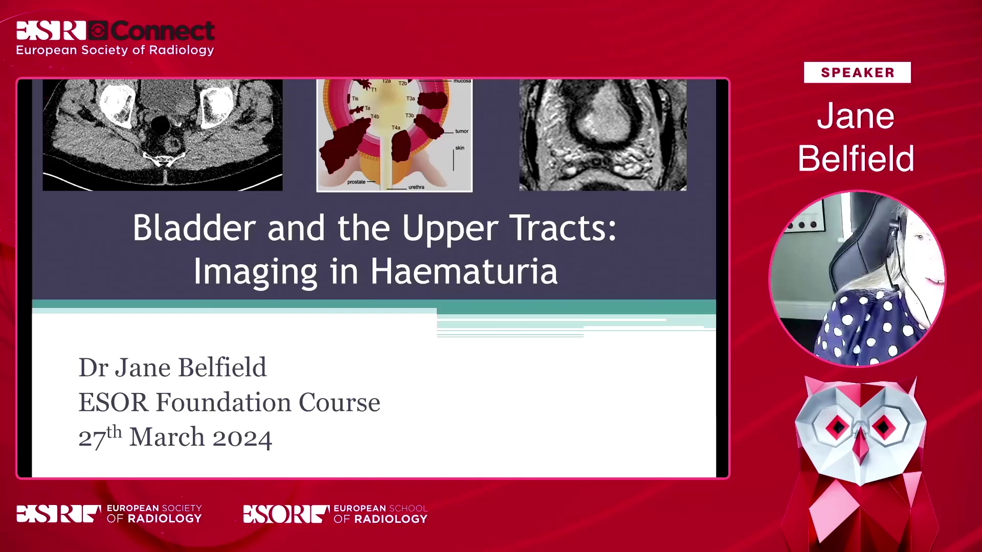 Bladder and the upper tracts: imaging in haematuria