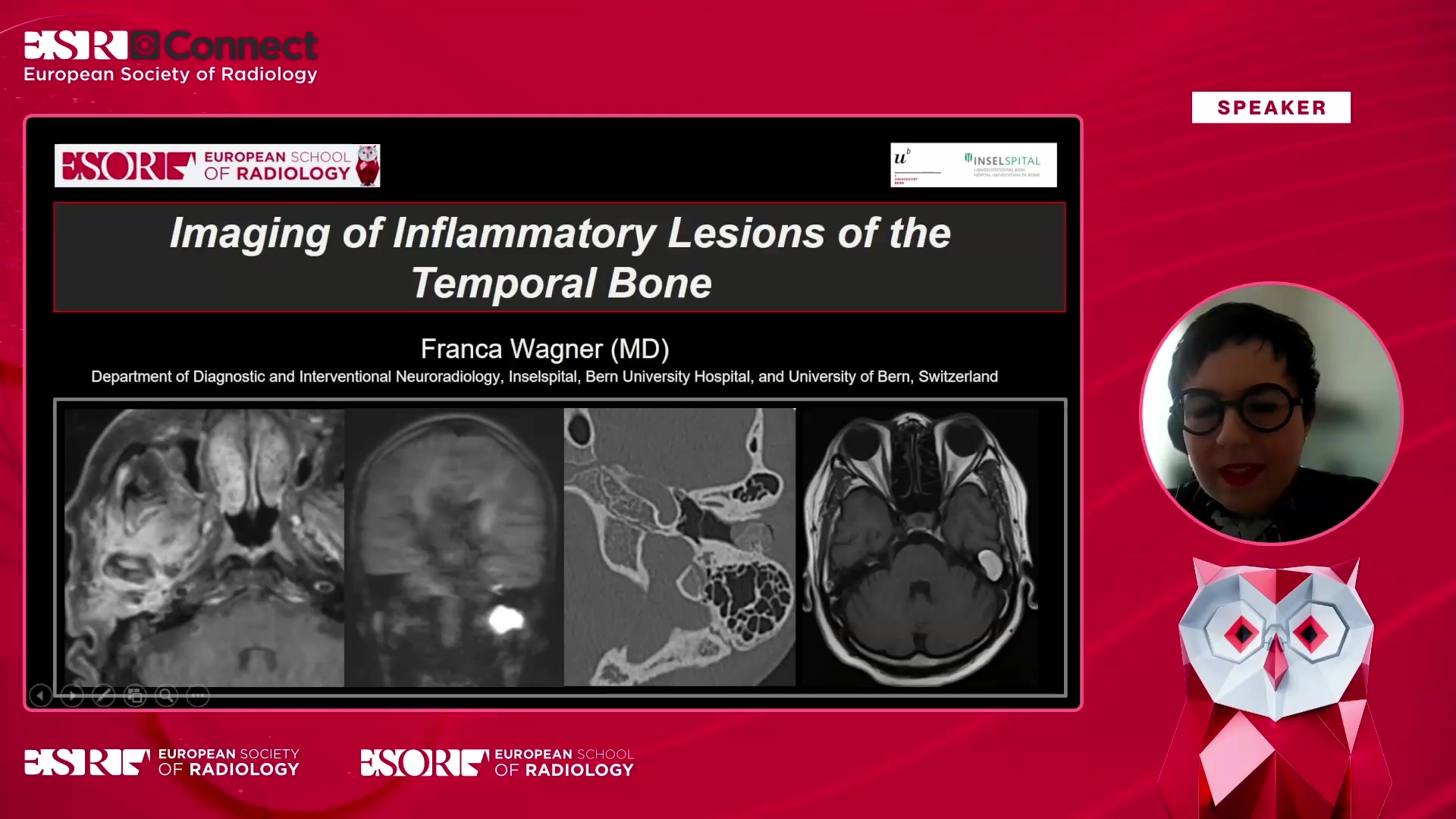 Imaging of inflammatory lesions of the temporal bone