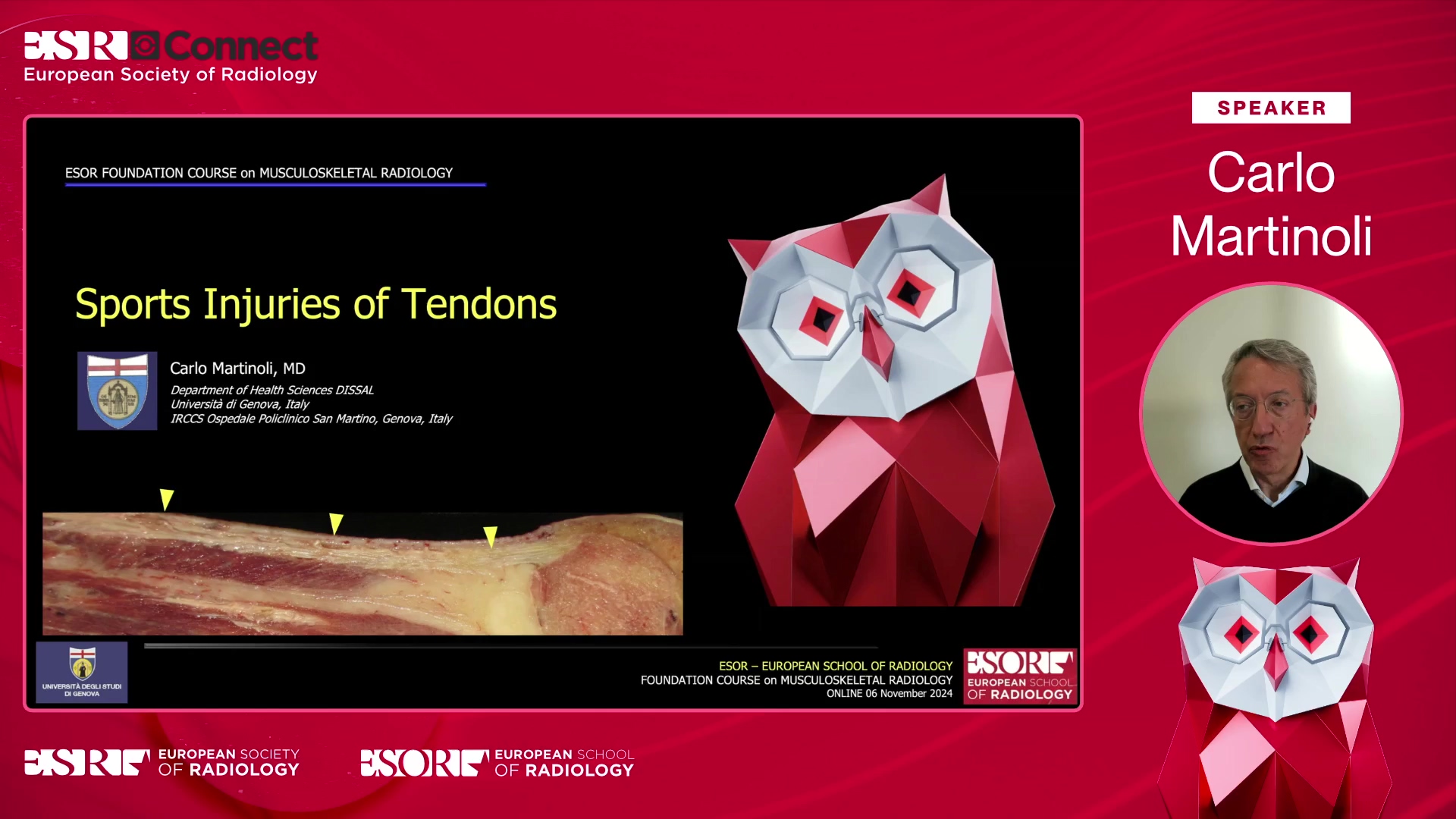 Sports injuries of tendons