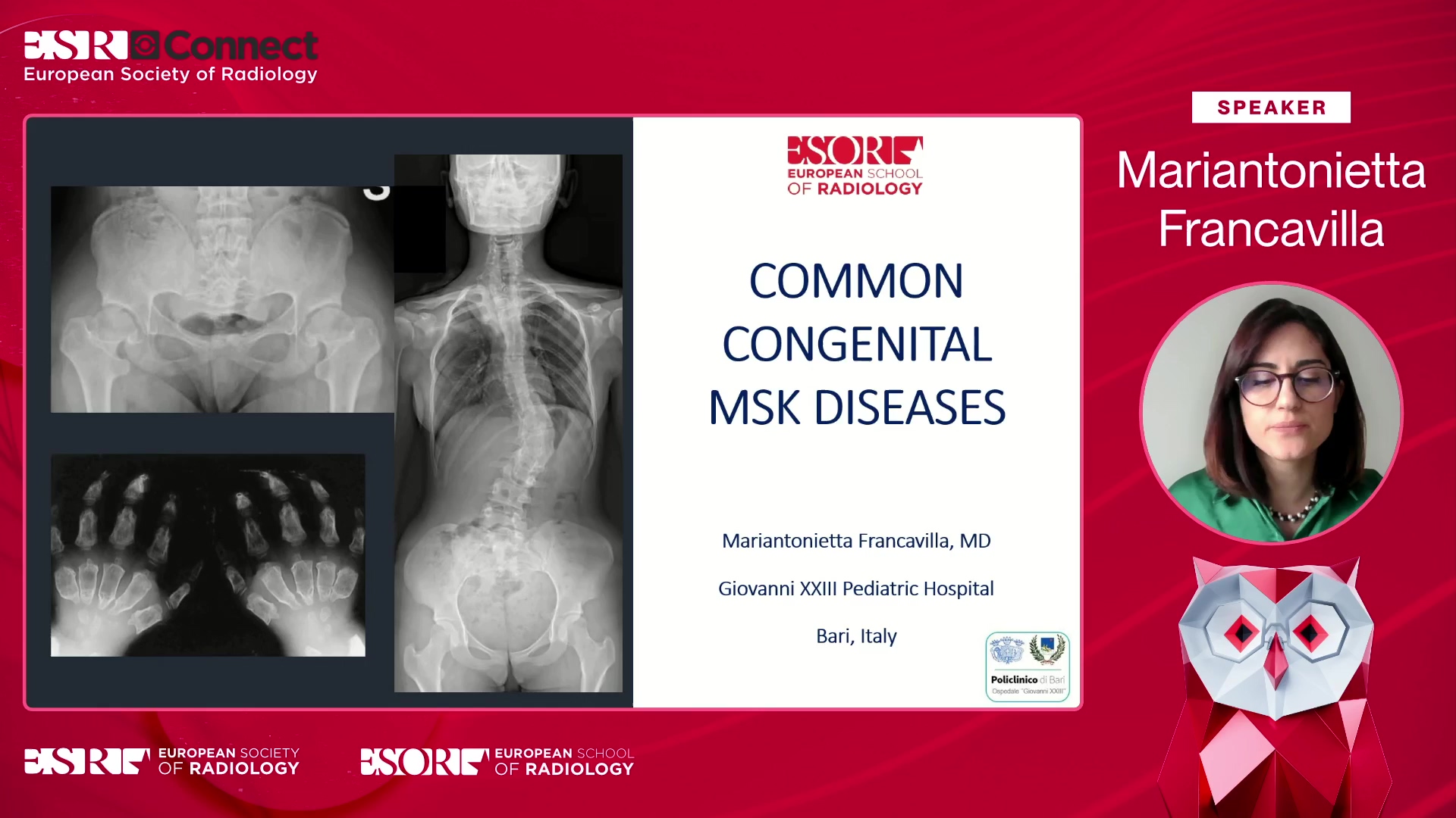 Congenital paediatric diseases