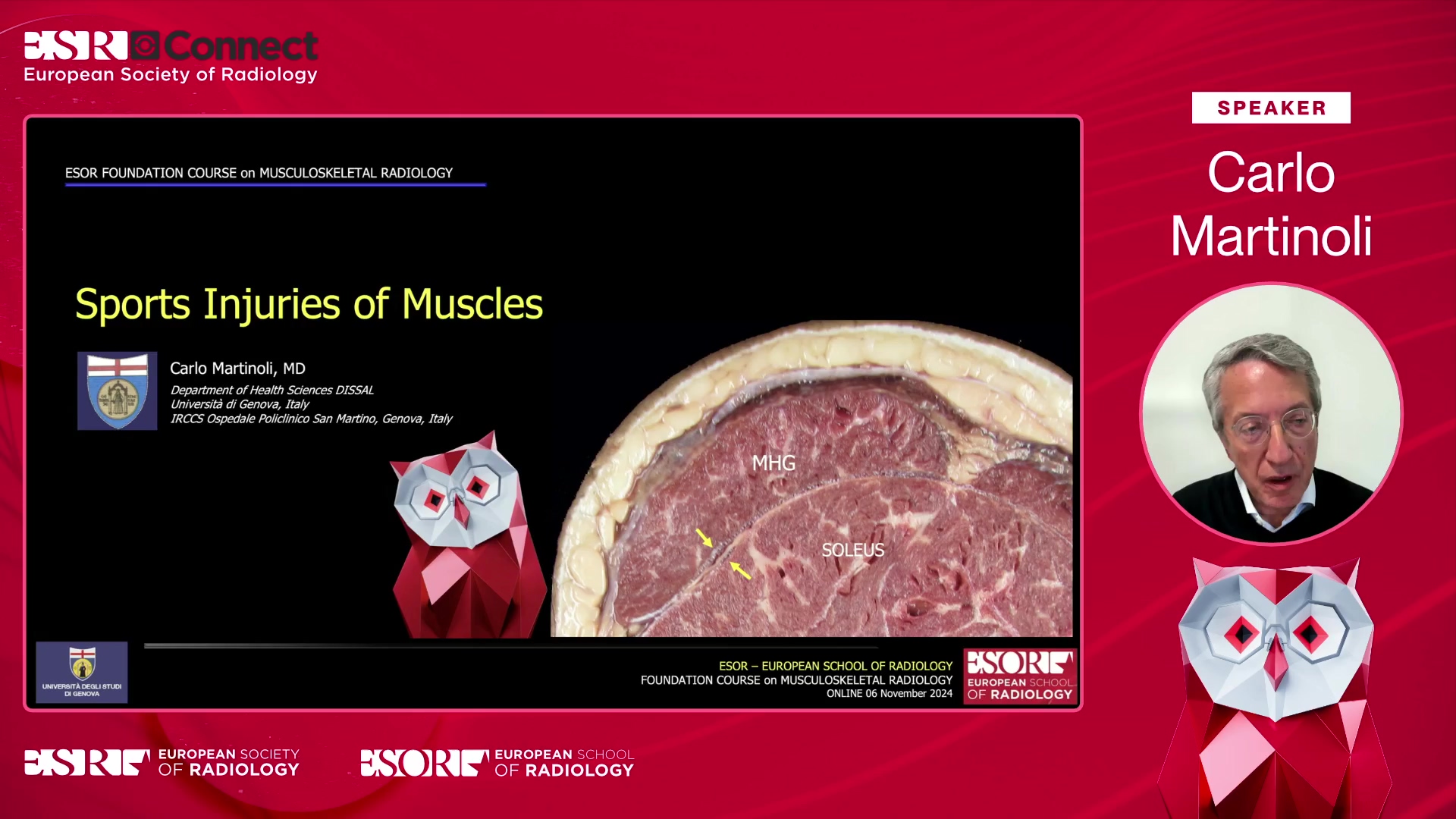 Sports injuries of muscles