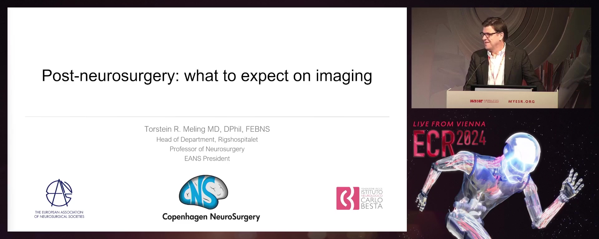 Post-neurosurgery artifacts on MRI imaging