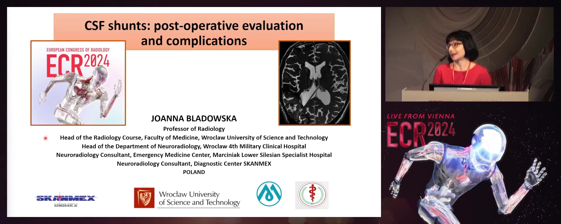 CSF shunts: post-operative evaluation and complications