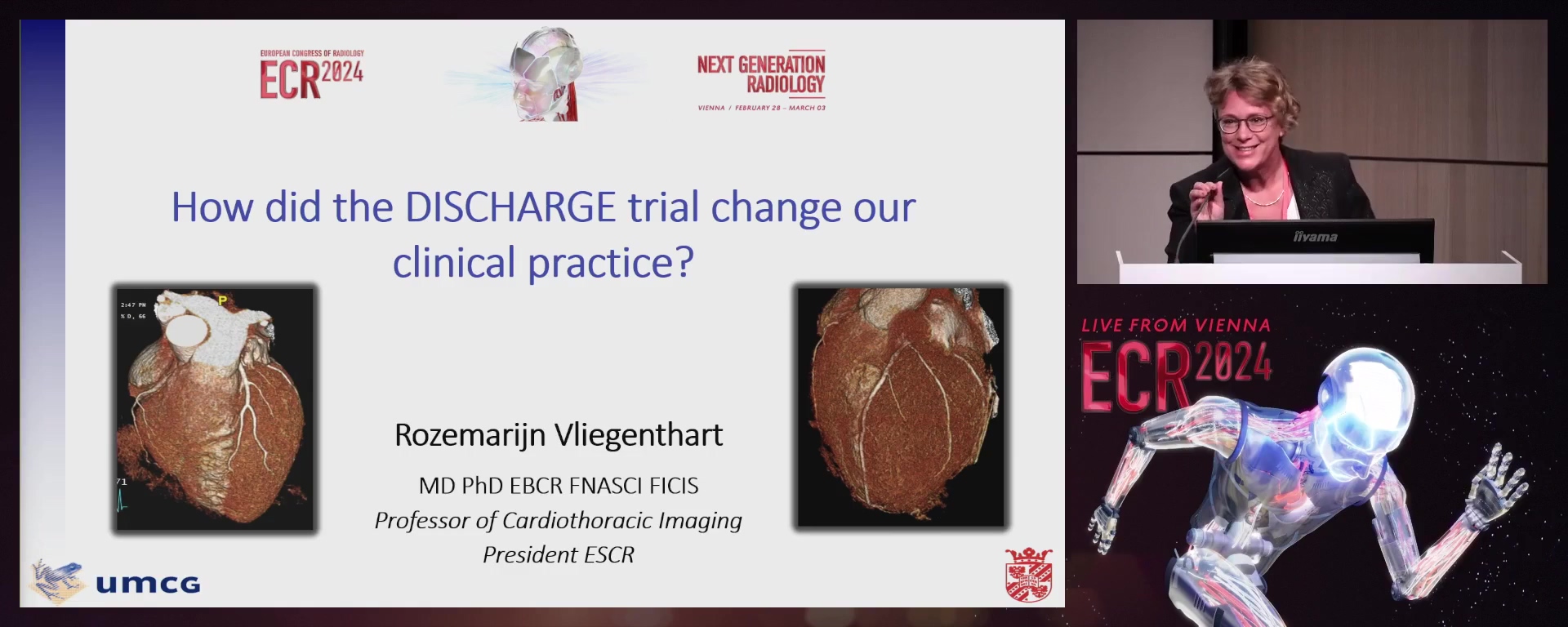 How did the DISCHARGE trial change our clinical practice?