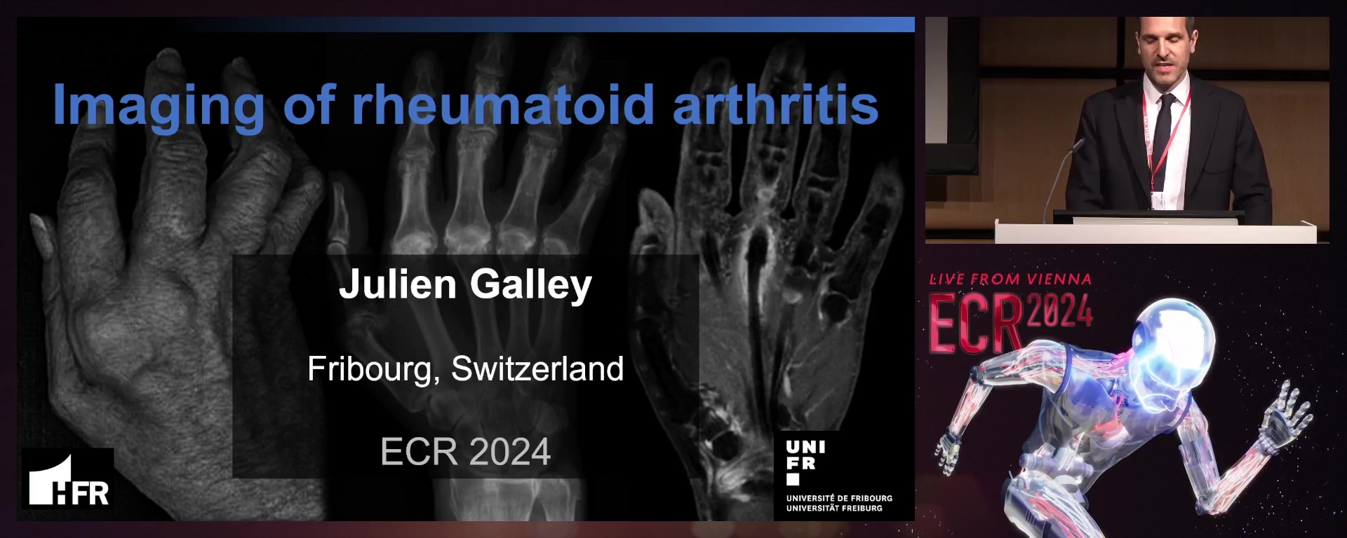 Imaging of rheumatoid arthritis