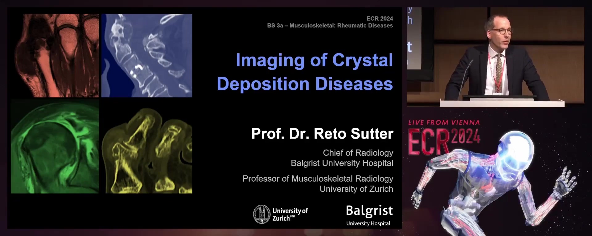 Imaging of crystal deposition diseases