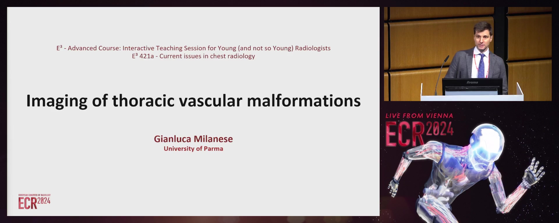 Imaging of thoracic vascular malformations