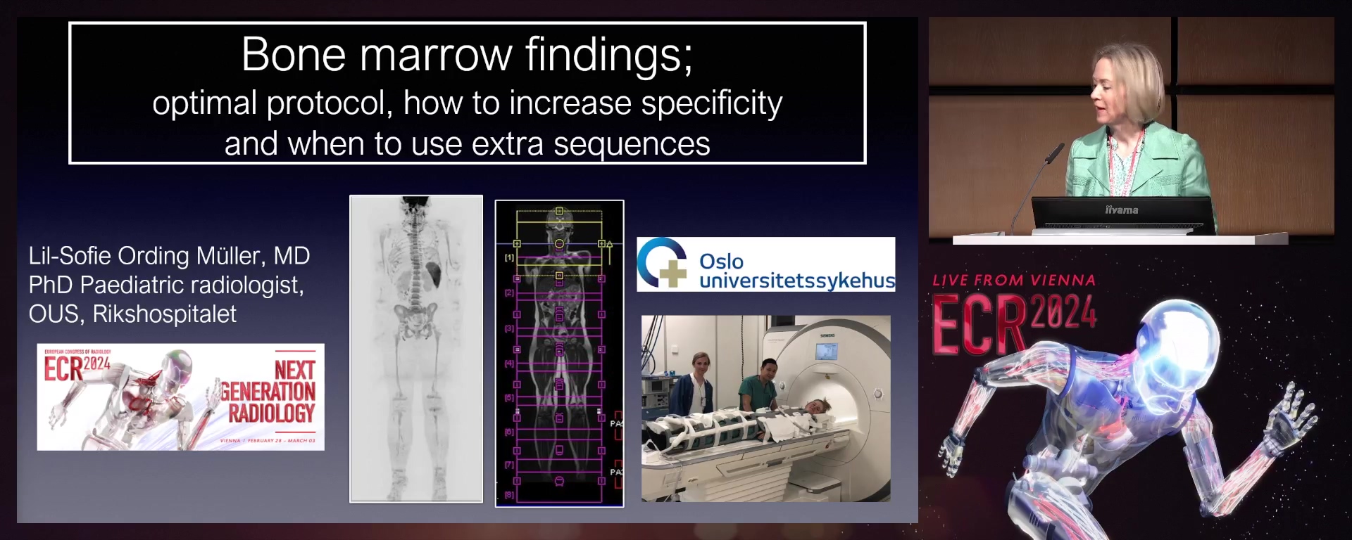 Optimal protocol: how to increase specificity and when to use extra sequences?