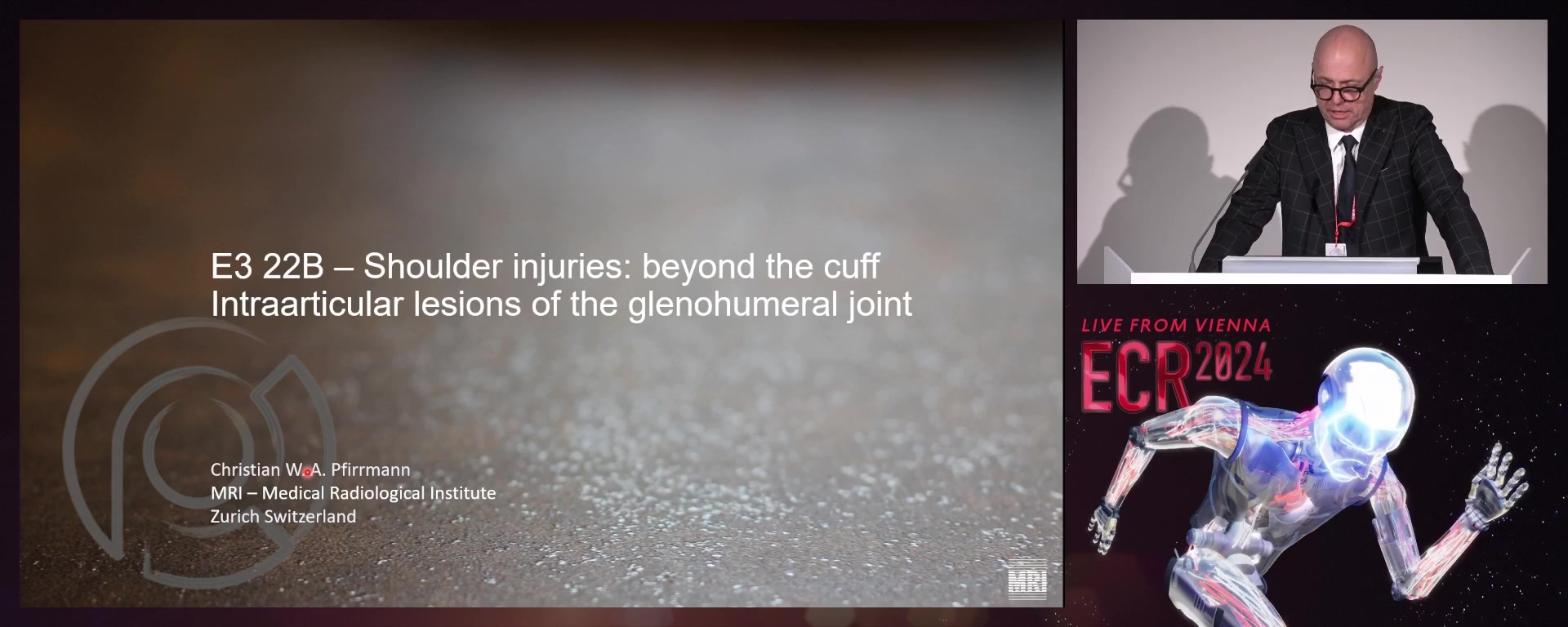 Intraarticular lesions of the glenohumeral joint