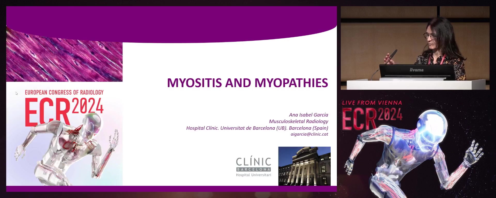 Myositis and myopathy