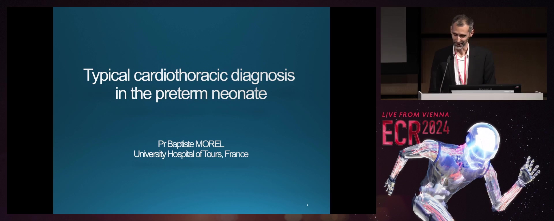 Typical cardiothoracic diagnosis in the preterm neonate