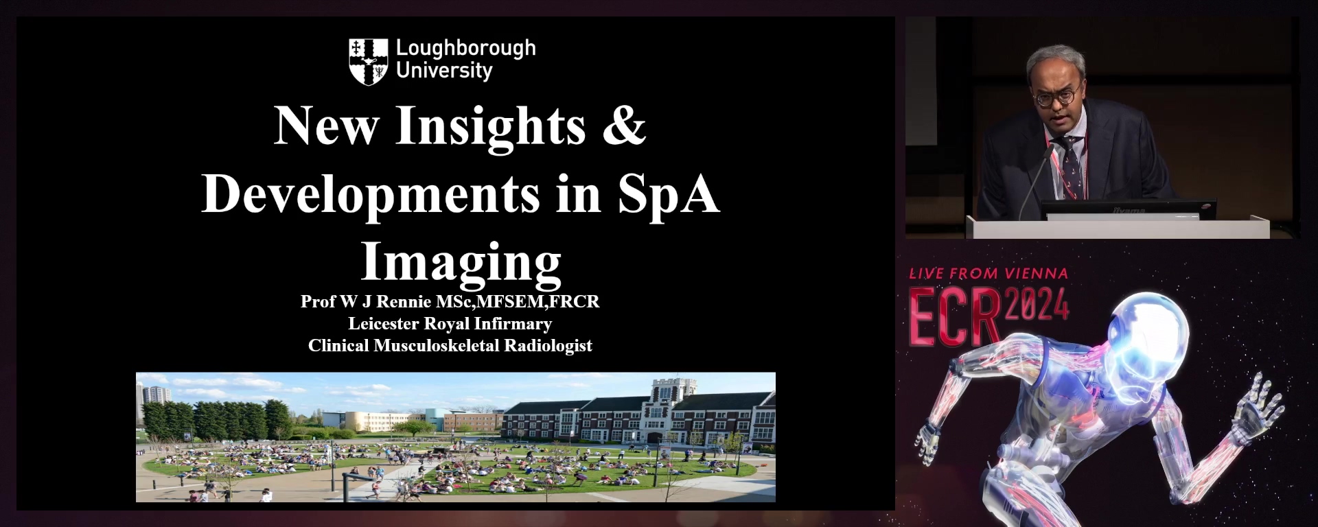 New insights and developments in imaging of spondyloarthropathy