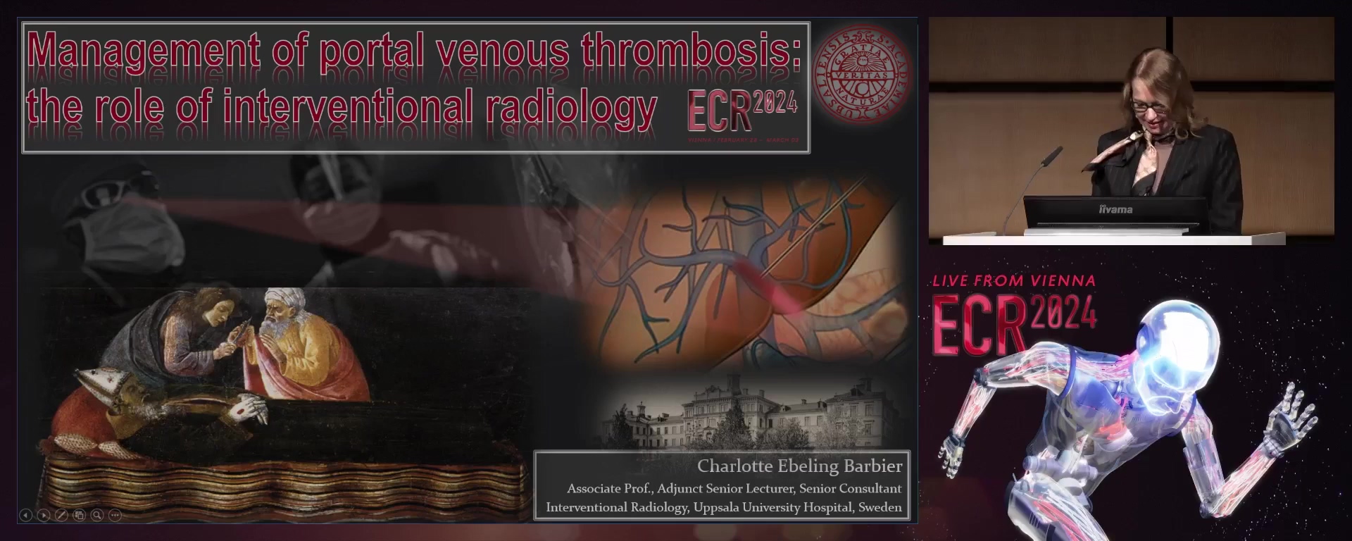 Management of portal venous thrombosis: the role of interventional radiology