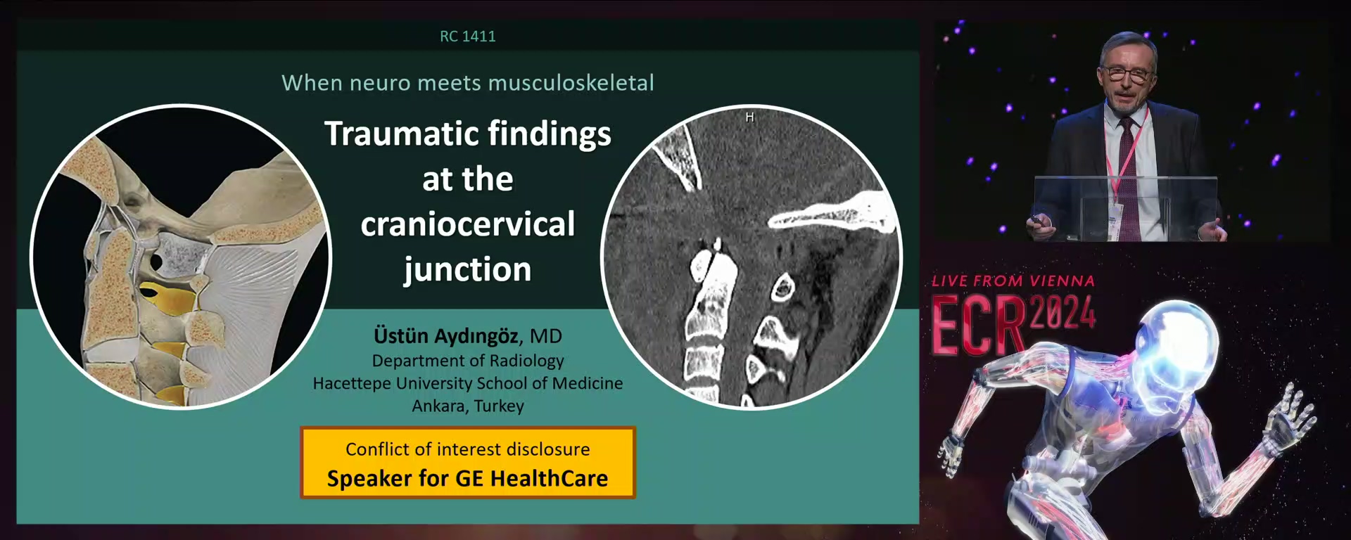 Traumatic findings at the craniocervical junction