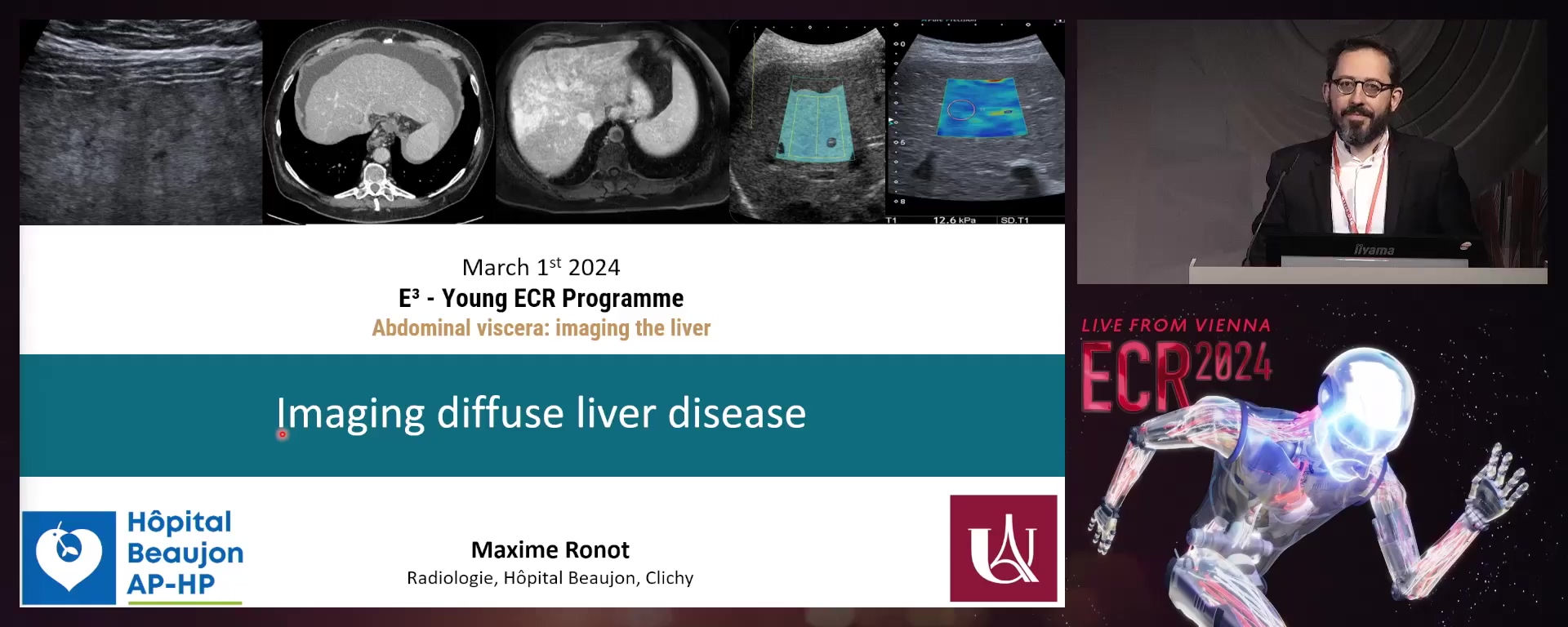 Imaging diffuse liver disease