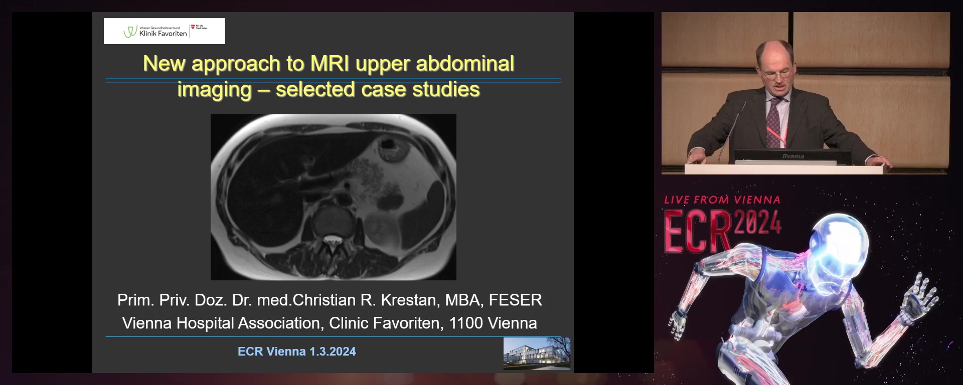New approach to MRI upper abdominal imaging – selected case studies